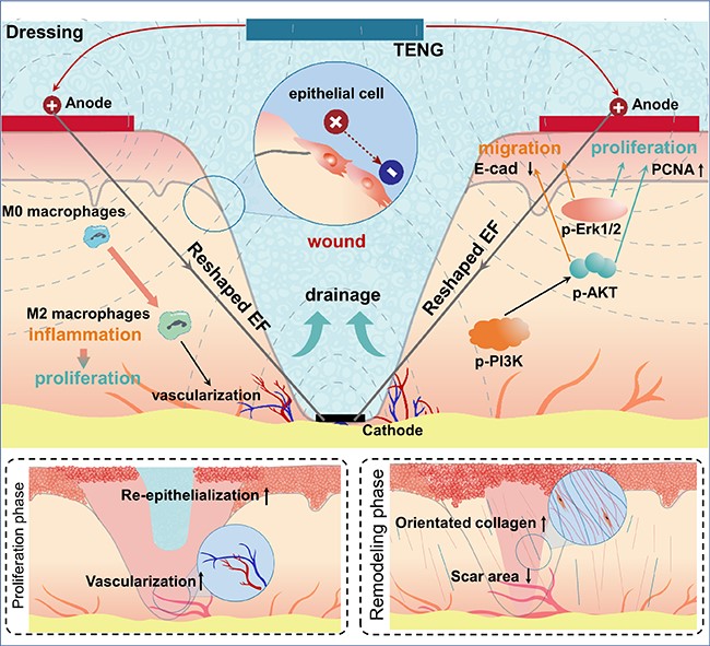 创面修复抗菌敷料怎么用【Advanced Materials】自供电敷料重塑伤口内源性电场促进创面修复_https://www.jmylbn.com_新闻资讯_第1张